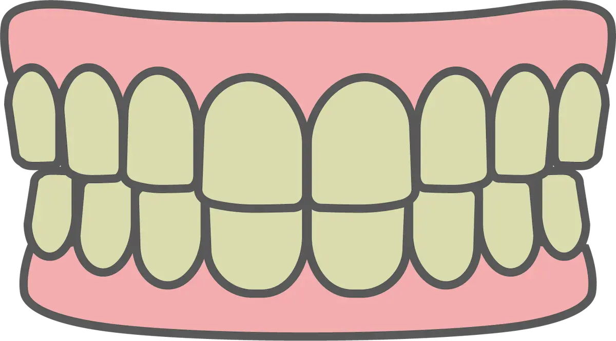 歯の黄ばみ｜東京都港区青山一丁目の歯医者