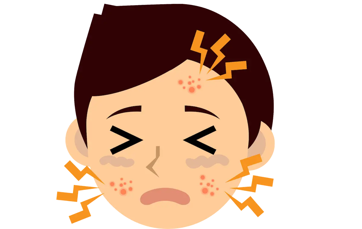 前歯　金属アレルギー