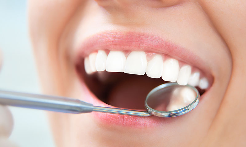 東京都港区青山の歯医者 予防歯科について