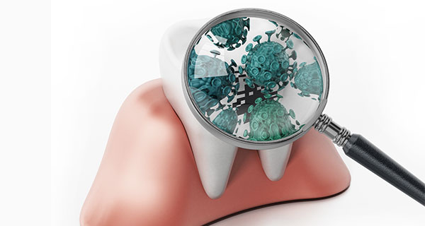 東京都港区青山の歯医者 細菌