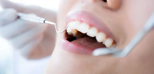 港区青山にある青山一丁目の歯医者　保険診療