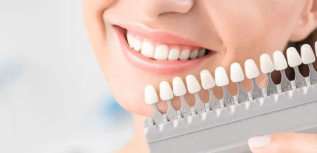 港区青山にある青山一丁目の歯医者　ホワイトニング