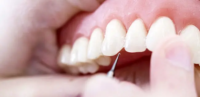 港区青山にある青山一丁目の歯医者　ジルコニア